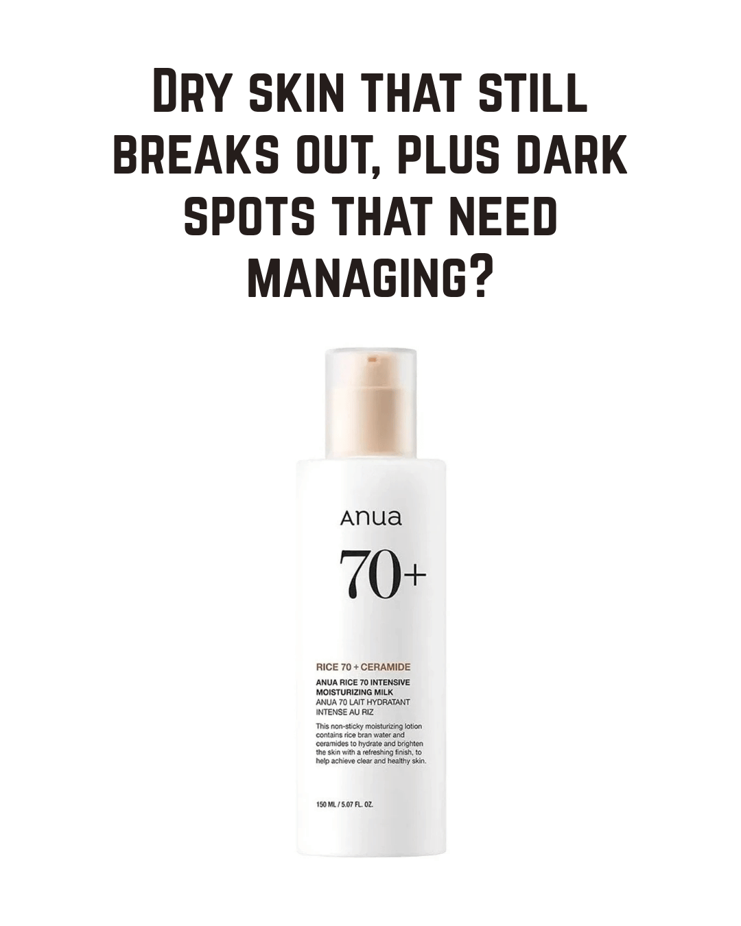 ANUA Rice 70 Intensive Moisturizing Milk — Lightweight Barrier-Building Hydration With Rice Water, Niacinamide, and Five Ceramides